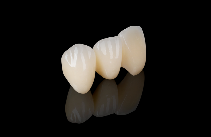 PFM High Noble White